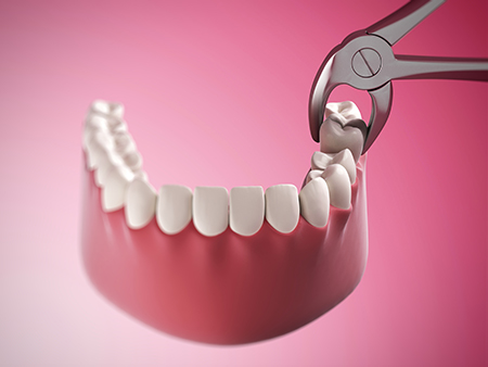 Florida Gardens Dental Center | Cosmetic Dentistry, Veneers and Emergency Treatment
