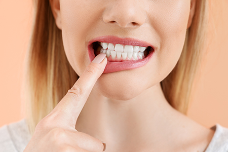 Florida Gardens Dental Center | Teeth Whitening, Oral Cancer Screening and Dental Fillings
