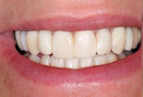 Lake Worth Cosmetic Dentist