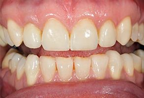 Cosmetic Dental Office near Lake Worth