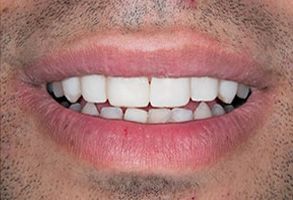 Dentist in Lake Worth