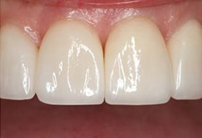 Dental Office near Lake Worth