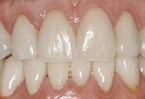 Lake Worth Cosmetic Dentist