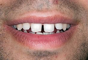 Dental Office near Lake Worth