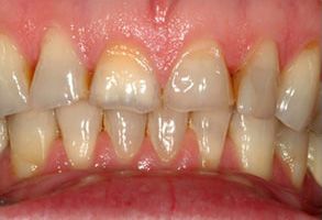 Lake Worth Cosmetic Dentist