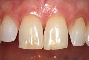 Cosmetic Dental Office near Lake Worth