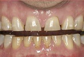 Dentist in Lake Worth