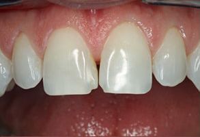 Lake Worth Cosmetic Dentist